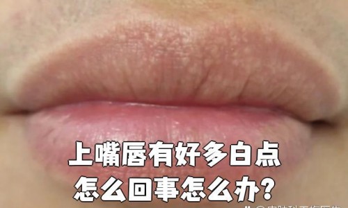 月经期间吃多少都不会胖吗为什么-月经期间吃多少都不会胖吗网 :分享经期吃的多正常吗-月经期间吃多了会怎样知识